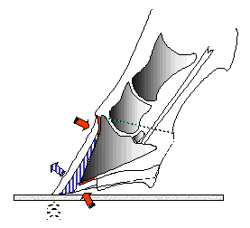 Fig 4: Overloaded dorsal wall after heel lowering