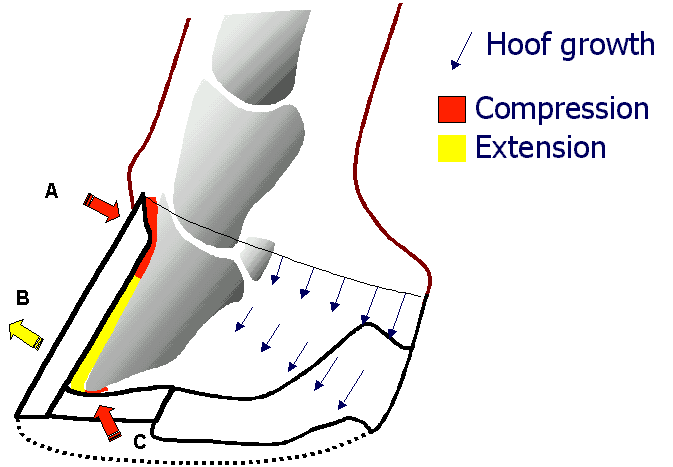 Fig 1 - The effects of rapid heel growth on the dorsal wall