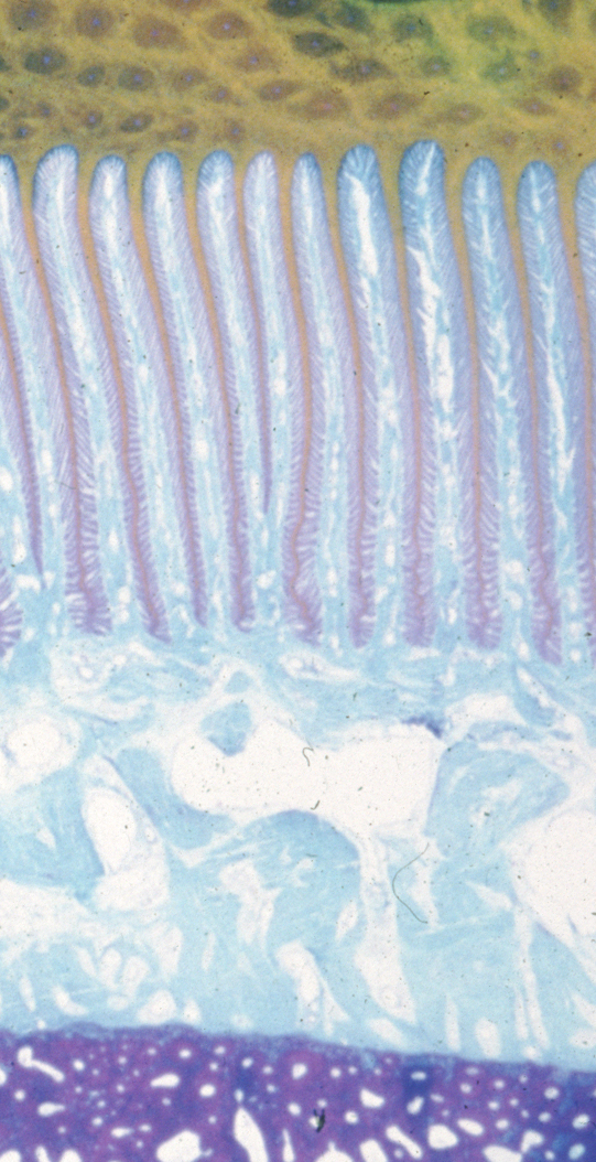 Normal dermal and epidermal laminae interlink