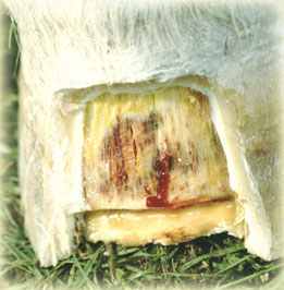 Fig.2: Dorsal wall resection and a horizontal groove cut at the boundary of the solar surface giving exit to a sub-solar abscess